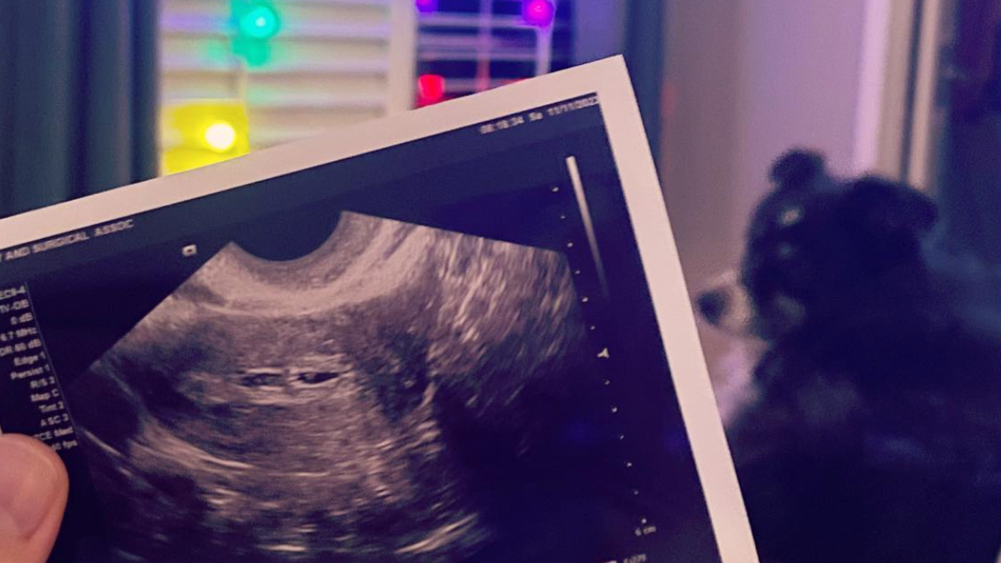 Understanding Your Beta HCG Numbers: What They Actually Mean (From Someone Who Had a 1.78)